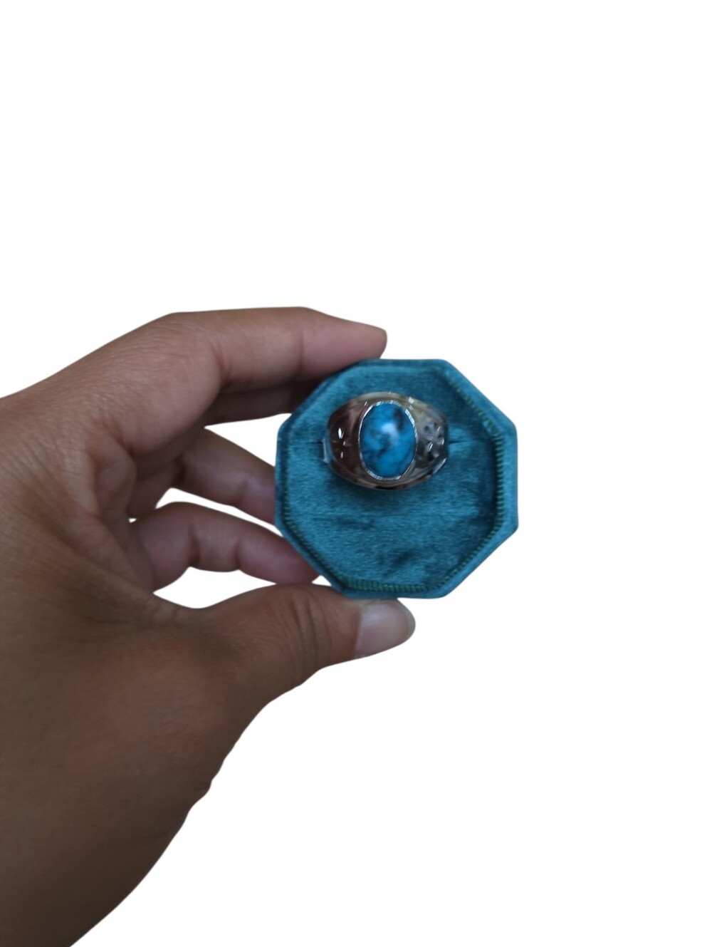 Size 11 Marbled Turqouise Blue Stone Ring